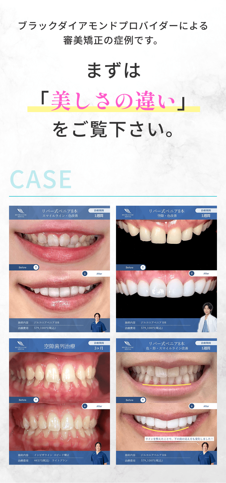 まずは「美しさの違い」をご覧下さい。